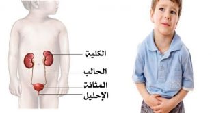 التهاب المسالك البولية عند الأطفال